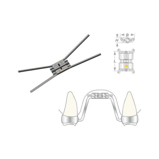 Vector 600 Gaumennahtschraube, Stück