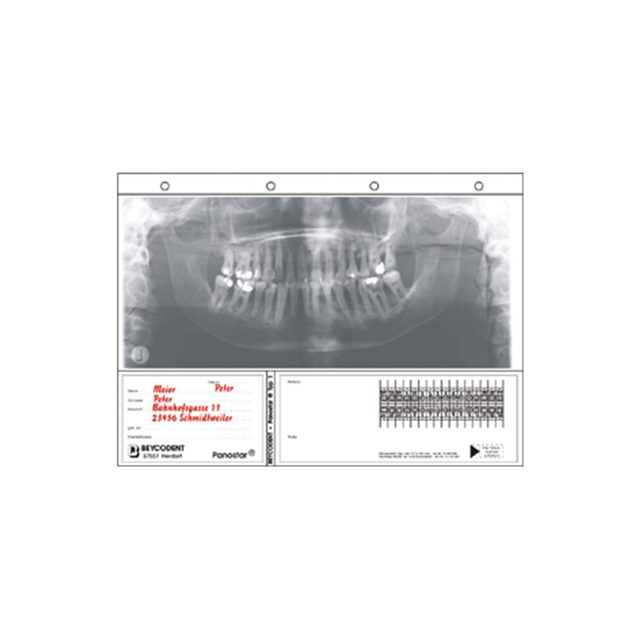 Panostar Typ 1 12,7x30,5 100 St Nfpa
