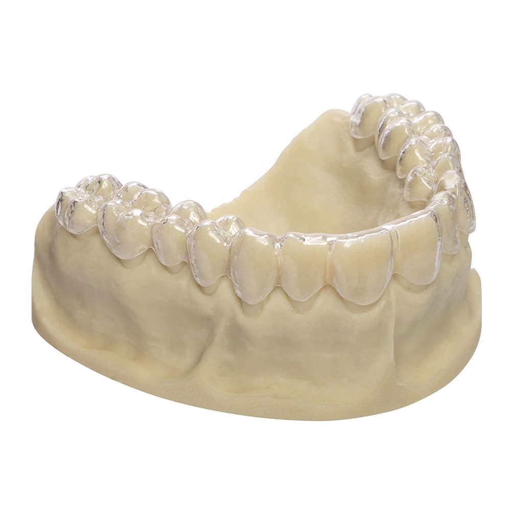 Biolon glasklar i.Alubtl. 125x0,75 40St