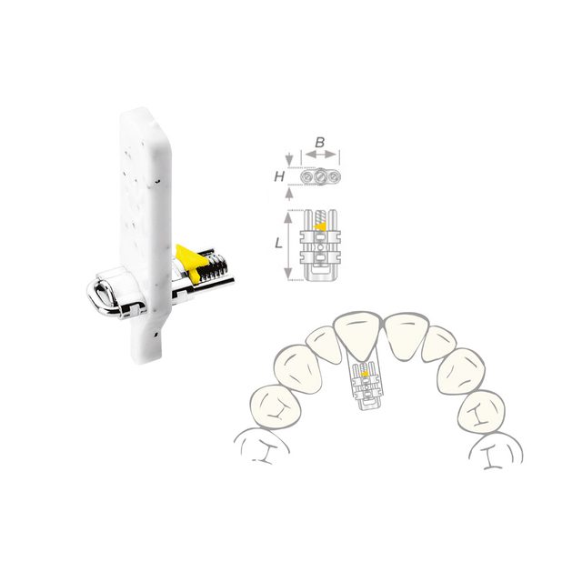 Dehnschraube Vector 350 micro, 10 Stück