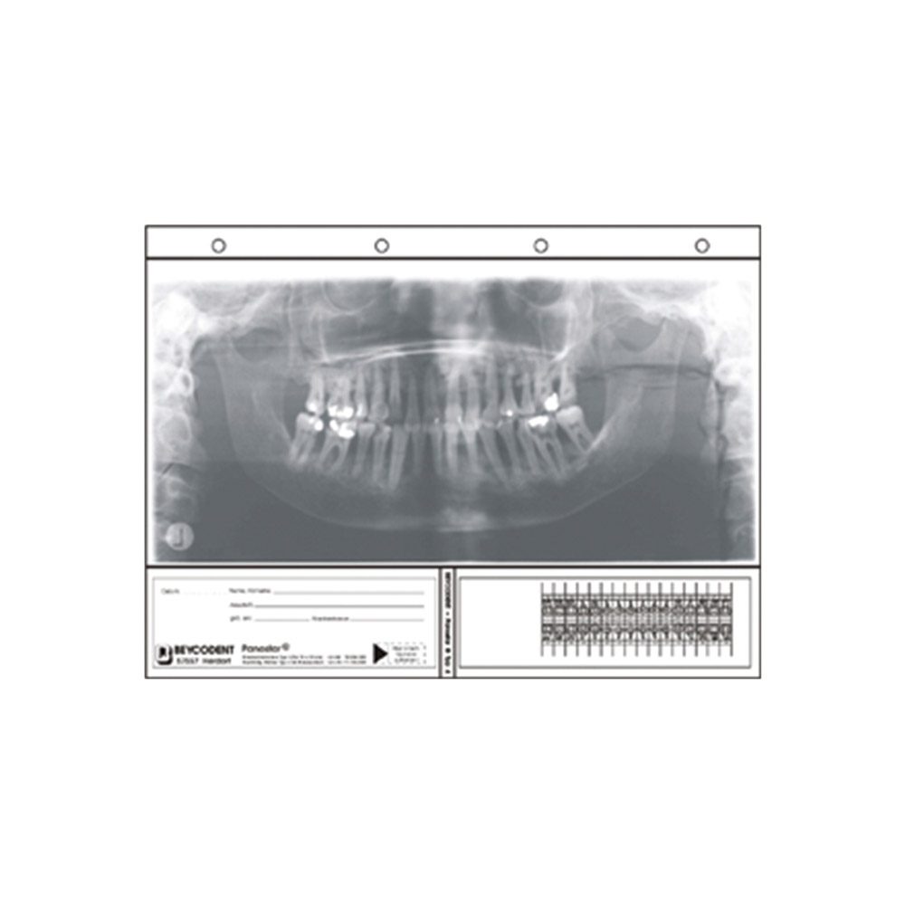 Panostar Typ 4 15x30,5 100 St Nfpa