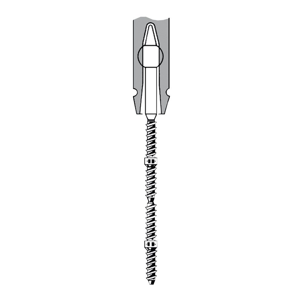 TMS Link plus Stifte Minim Titan 0,525 mm silber 24 Stück + Zubehör, Set