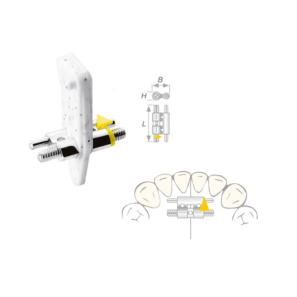 Dehnschraube Vector 080 medium 10St