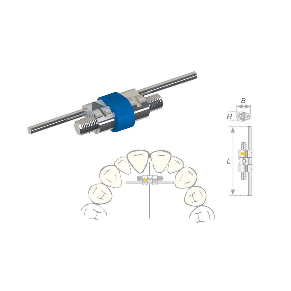 Vector 400 Sektoren Dehnschraube Mini, 10 Stück