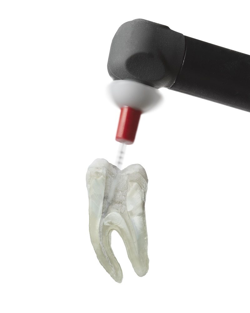 SmartLite Pro EndoActivator Nfpa