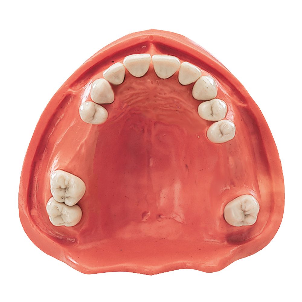 Gingiva Modell OK 12/2, Stück