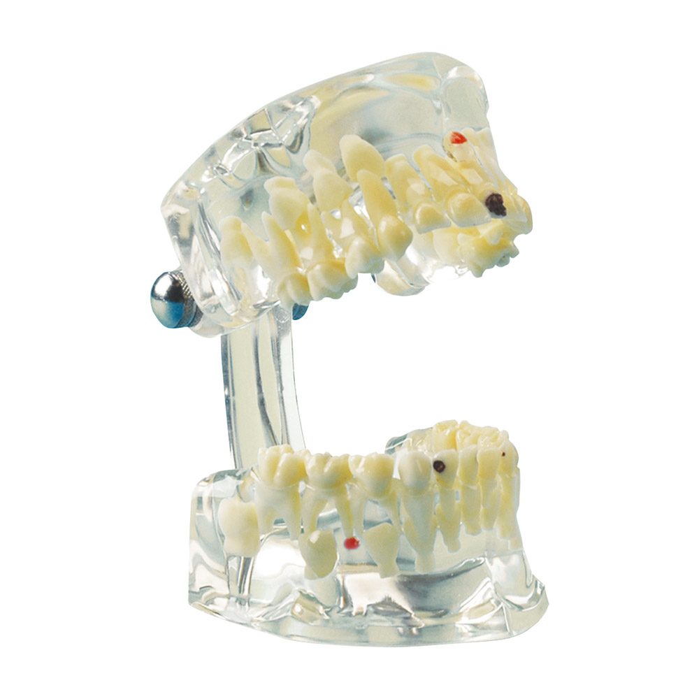Studienmodell Transparent Kind, Stück