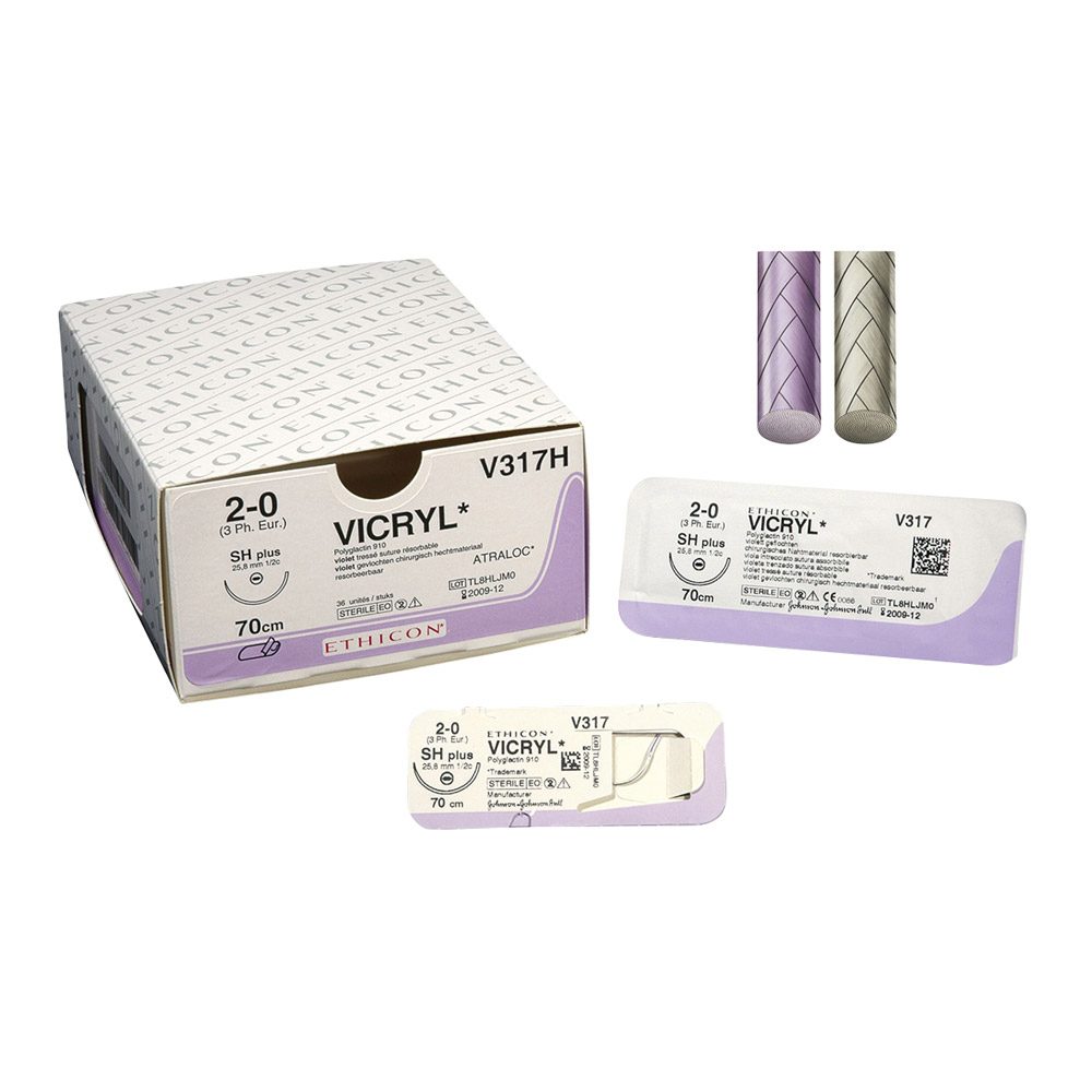 Vicryl ungefä. 4-0/1,5 FS2 3Dtz
