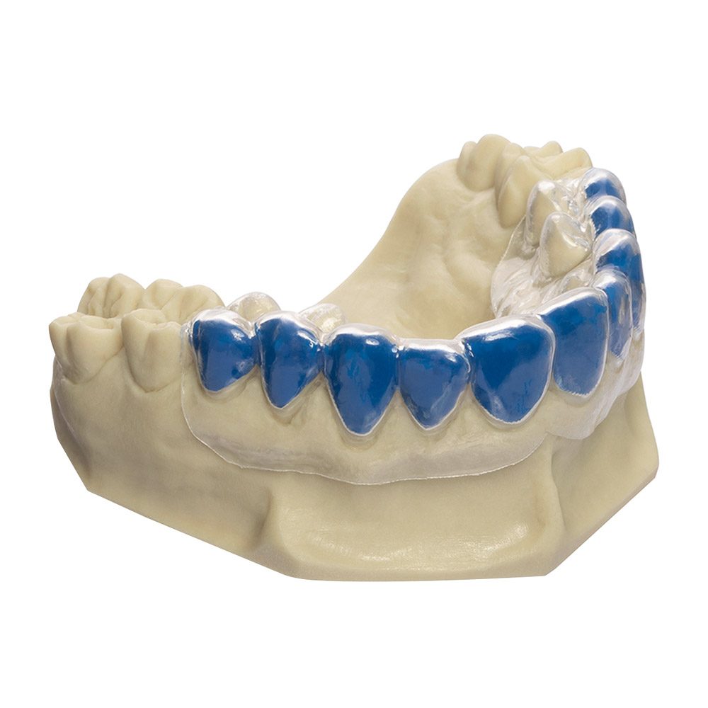Drufolen W 0,65x125mm blau  40St