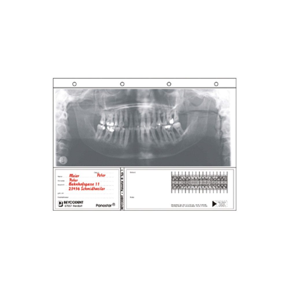 Panostar Typ 1 12,7x30,5 100 St Nfpa