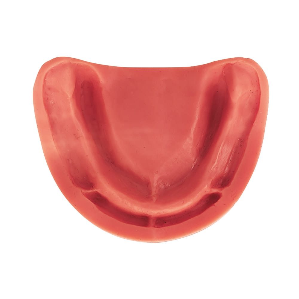 Studienmodell UK UB Gingiva St